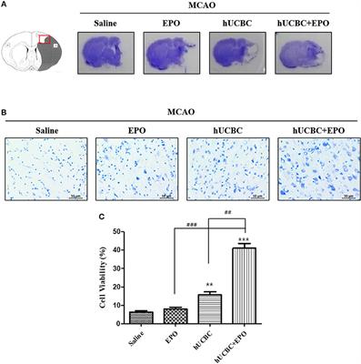 Combining Human Umbilical Cord Blood Cells With Erythropoietin Enhances Angiogenesis/Neurogenesis and Behavioral Recovery After Stroke